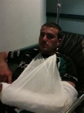 David Edbrooke's Dislocated elbow. Acquired during game against Tonmawr 2nds.